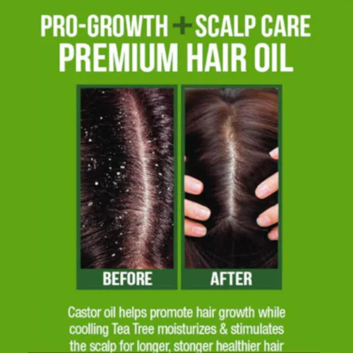 Vista 4 de Difeel Premium Castor Plus Tea Tree - Pro-Growth + Scalp Care Aceite para el cabello prémium de 2.5 onzas