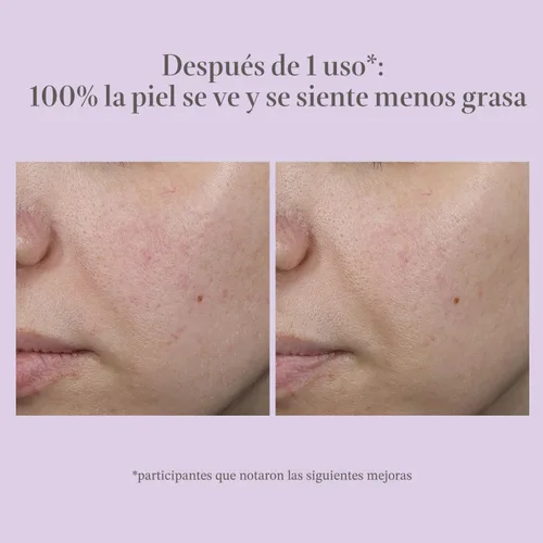 Vista 8 de EXUVIANCE Performance Peel AP25, At-Home Chemical Peel with Glycolic Acid, Gently Refines Pores, Anti-Aging Peel, Treats Fine Lines, Wrinkles &