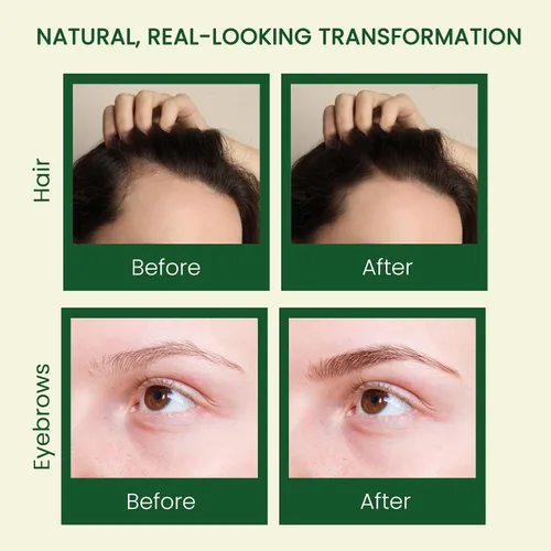 Vista 3 de Aceite de ricino puro (10 onzas), aceite de ricino 100% prensado en frío para el crecimiento del cabello, piel, cejas, pestañas de ojos, uñas