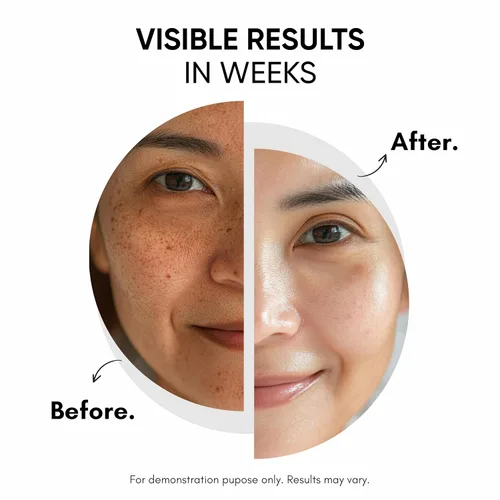 Vista 4 de Masofta Crema facial y corporal 2% de ácido kójico para pigmentación, melasma, marcas de acné, axilas, cuello, para hombres y mujeres, 1.0 fl oz
