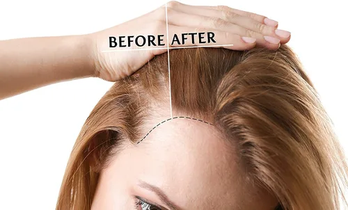 Vista 4 de Aceite de semilla de sandía, puro, sin refinar, prensado en frío, virgen, aceite portador, 8 onzas, para cabello, piel, uñas, cuerpo, vello facial