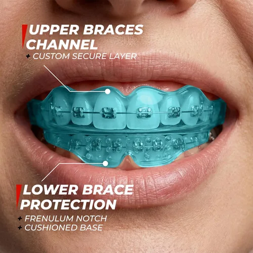 Vista 3 de SafeGrin Protector Bucal Azul para Brackets para Deportes - Silicona Premium para Adolescentes y Jóvenes, Protección de Dientes Superiores e
