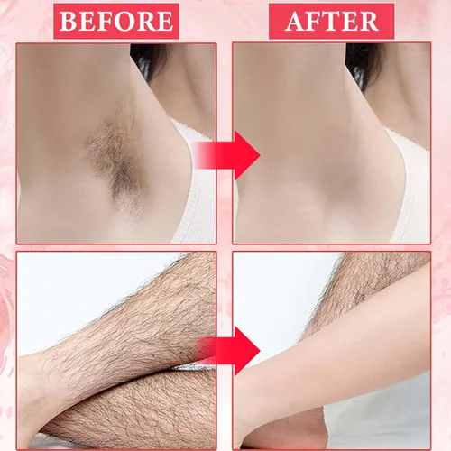 Vista 3 de Gel refrescante para depilación, gel facial transparente de acoplamiento y gel de enfriamiento con dispositivo de depilación láser y máquina