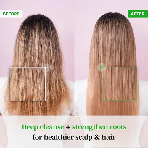 Vista 2 de Champú TS Premium 10.14 fl oz / 300g para prevención de pérdida de cabello, champú biotina antiadelgazamiento, champú coreano, rutina diaria natural