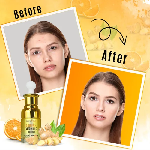 Vista 5 de Suero de vitamina C de jengibre para la cara, suero facial orgánico con ácido hialurónico y raíz de cúrcuma, hidratante para piel opaca y seca