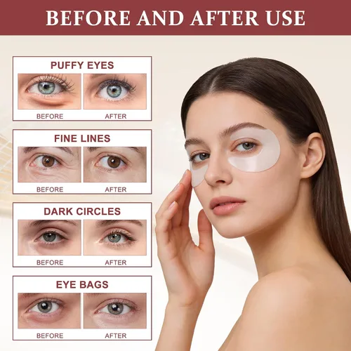 Vista 3 de Ycz Parches para debajo de los ojos (30 pares) – Máscaras de ojos con cafeína para ojos hinchados, ojeras y líneas finas, deshinchamiento