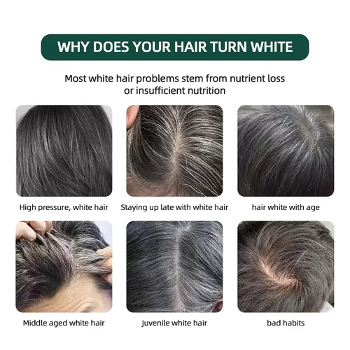 Vista 2 de Barra de champú natural Usman Grass, cubre el cabello gris, barra Usma para engrosar y oscurecer el cabello, la solución definitiva