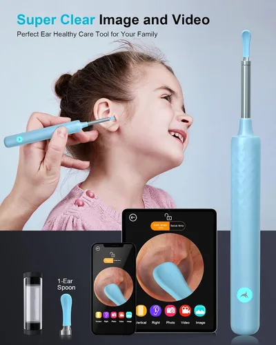 Vista 2 de DJROLL Eliminación de cera de oído, herramienta de eliminación de cerumen, cámara de oído, visor de oído con herramienta limpiadora de cera de oído