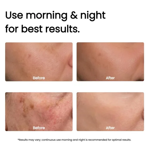 Vista 5 de Luminoso 24% Skin Revival Serum – Niacinamida 10%, Arbutina 7%, VC Etil 4%, Ácido Tranexámico 3% – Revitaliza la piel opaca, tono correcto y cutis