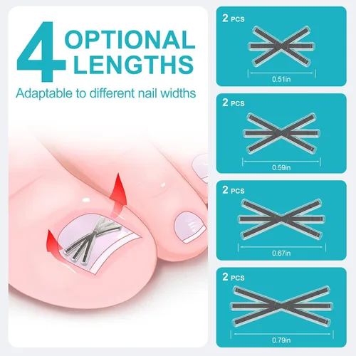Vista 2 de Kit de tratamiento de uñas encarnadas con forma mejorada de 6 ángulos, herramientas correctoras de uñas encarnadas de aleación de titanio con 4