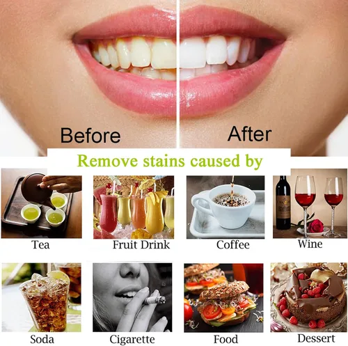 Vista 7 de Polvo de carbón para blanquear los dientes, polvo blanqueador de dientes para el cuidado bucal Establece coco natural, sin daño en esmalte o encías