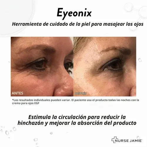 Vista 7 de Nurse Jamie Eyeonix - Herramienta de belleza para masaje ocular