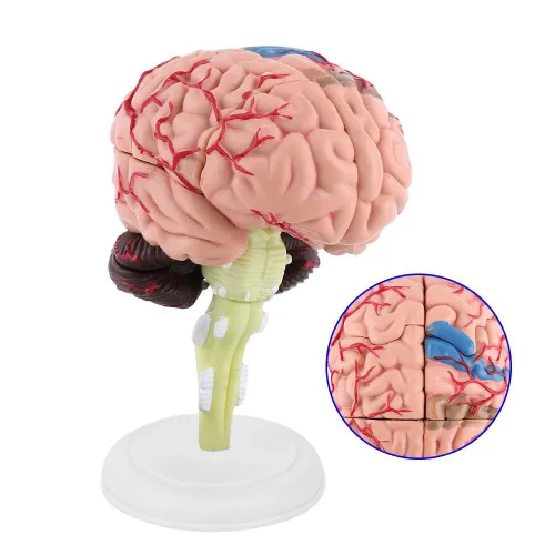 Vista 7 de Modelo de cerebro de anatomía 4D Desmontado Modelo de cerebro humano Anatomía estructural Herramienta de aprendizaje de enseñanza médica
