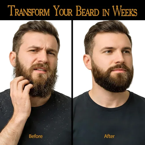 Vista 4 de BodyJ4You Aceite orgánico para barba para hombres - Acondicionador