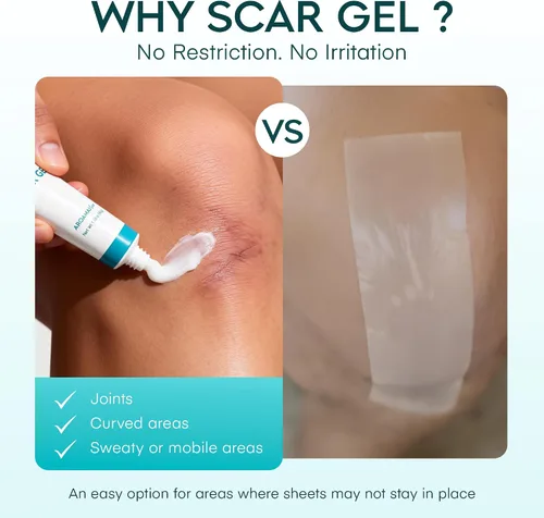 Vista 4 de Aroamas Scar Gel avanzado para cicatrices, gel de silicona de grado médico para ayudar a mejorar la apariencia de cicatrices y estrías para rostro