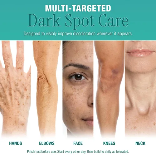 Vista 7 de Ebanel Eliminador de manchas oscuras para rostro y cuerpo, suero iluminador con Synovea HR, alfa arbutina, niacinamida, ácido kójico, corrector