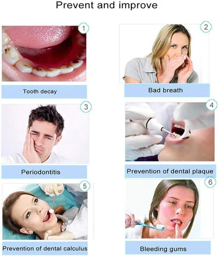 Vista 6 de Irrigador dental de agua manual portátil – Irrigador oral inalámbrico no eléctrico con tecnología de presión de aire, fácil de usar para la limpieza