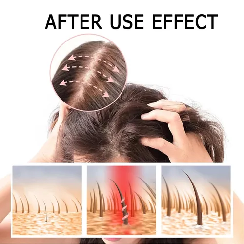 Vista 2 de Champú para el cabello con extracto de planta de jengibre anticaída para el crecimiento del cabello, 2 cajas (14.11 oz), control de aceite