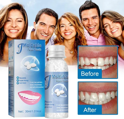 Vista 3 de Kit de reparación dental, perlas para reparación de dentaduras, pinzas, mondadientes, herramientas dentales para fijar, rellenar, dientes faltantes