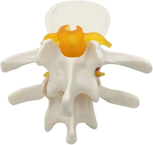 Vista 4 de Modelo de columna vertebral de hernia de disco lumbar, aumento 1.5X anatómica hernia lumbar humana disco intervertebral para enseñanza escolar