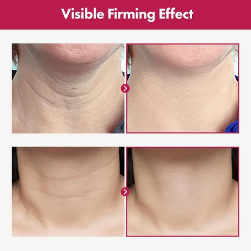 Vista 3 de TOSOWOONG Crema de colágeno Necktox con colágeno y ácido hialurónico para reafirmar el cuello, antienvejecimiento, arrugas y tensamiento, cuidado