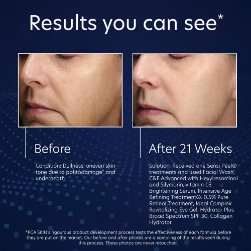 Vista 8 de PCA SKIN Suero iluminador de vitamina B3, suero antienvejecimiento para manchas oscuras y decoloración de la piel, fabricado con niacinamida