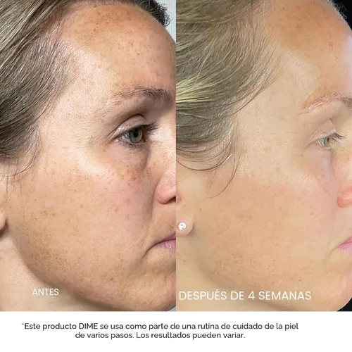 Vista 4 de DIME Beauty TBT Cream – Crema de noche antiarrugas con Bakuchiol Retinol alternativa para líneas finas, crema hidratante facial reafirmante