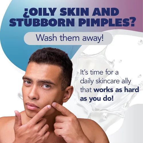 Vista 2 de Asepxia Jabón en barra para tratamiento del acné con bicarbonato de sodio, lavado facial, limpieza profunda, extractos naturales, uso diario suave