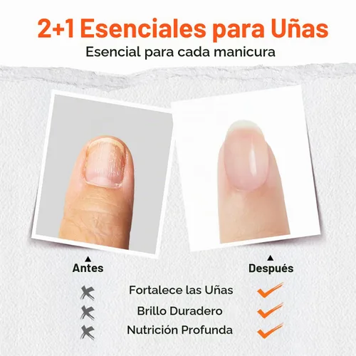 Vista 3 de modelones capa superior y base de esmalte de uñas 3 en 1, fortalecedor de uñas, 15 ml esmalte de uñas transparente de secado rápido, brillo duradero