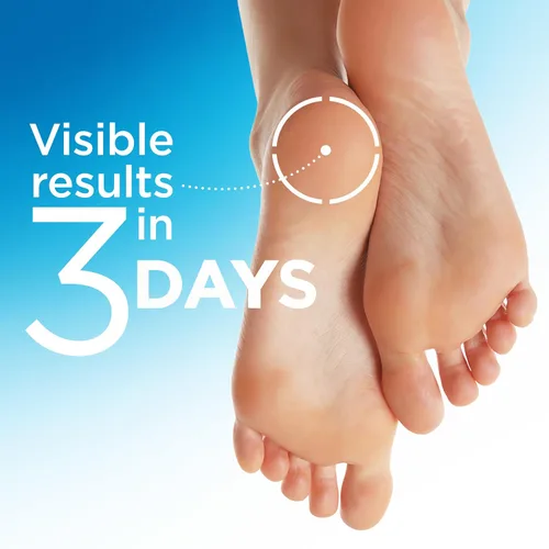 Vista 2 de Flexitol Heel Magic para piel seca o talones ásperos con manteca de karité y vitamina E, 2.5 onzas