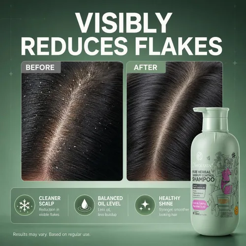 Vista 3 de Champú anticaspa con ácido salicílico y olamina piroctona, alivio avanzado de la picazón para cuero cabelludo escamoso y acumulación, ginseng