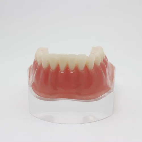 Vista 8 de Color dorado dental del diente inferior de la sobredentadura del implante de la precisión 4 modelo de los dientes
