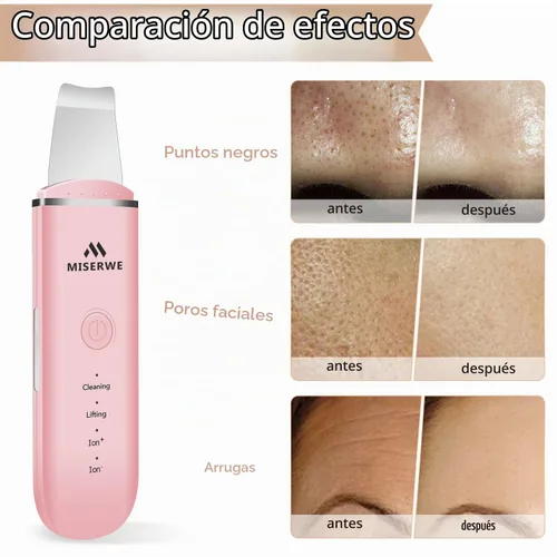 Vista 5 de Espátula facial para la piel, limpiador de poros con 4 modos (Rosa)