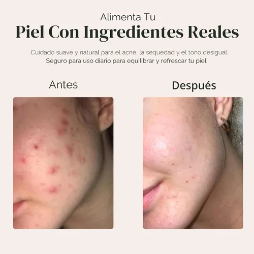 Vista 6 de era of nature El mejor jabón negro africano orgánico crudo, para pieles secas y condiciones de piel. Ingredientes puros y naturales, importados