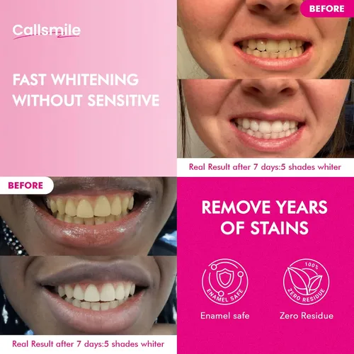 Vista 4 de CALLSMILE Tiras blanqueadoras de dientes - Tiras blanqueadoras para dientes sensibles, blanqueador de dientes de peróxido de hidrógeno para café