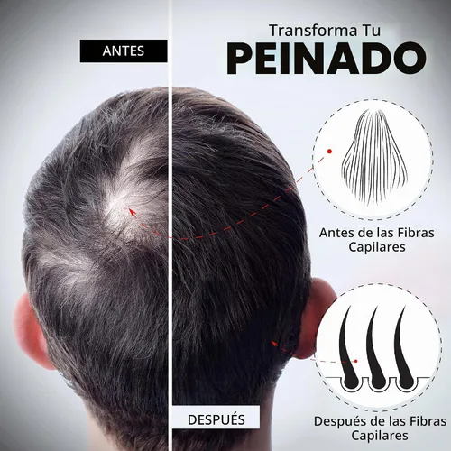 Vista 3 de ELEVATE Fibras capilares para adelgazar el cabello, tamaño grande, botella de 1.41 onzas, fibras de queratina 100% naturales indetectables