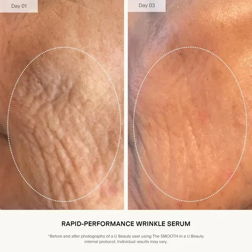 Vista 3 de U Beauty The SMOOTH Dynamic Wrinkle Defense Serum - Complejo multipéptido, péptidos de cobre, retinol, exosomas de centella, proteína de seda vegana