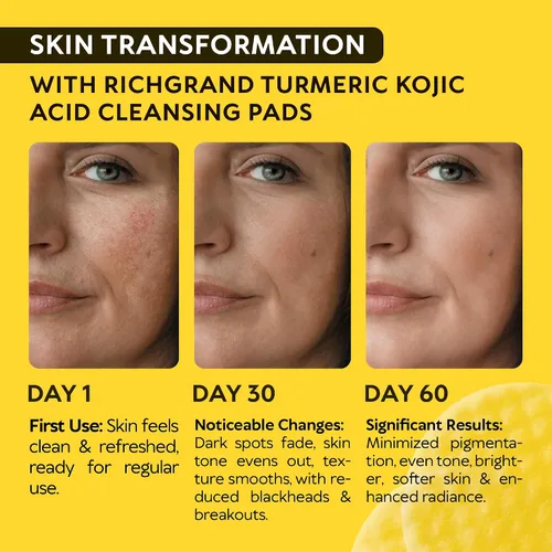 Vista 2 de Almohadillas limpiadoras de ácido kójico de cúrcuma para la cara, esponjas exfoliantes con vitamina C y limón, lavado facial espumoso para una piel