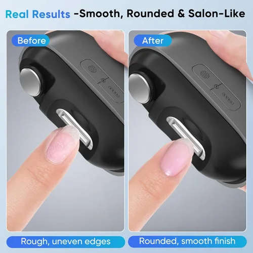 Vista 3 de Cortaúñas eléctrico con luz LED y almacenamiento de uñas, recortadora inteligente recargable de uñas y uñas de los pies para personas mayores
