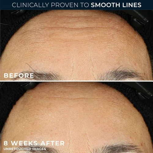 Vista 4 de RoC Retinol Correxion Line - Cápsulas de suero de noche suavizante, tratamiento diario antienvejecimiento para líneas finas, manchas oscuras
