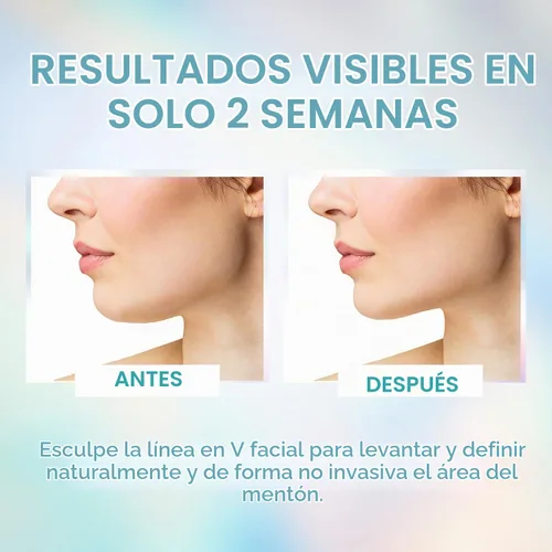 Vista 5 de Venus Visage Correa de elevación facial para definición de línea de mandíbula, correa de barbilla reutilizable para dormir, esculpe visualmente