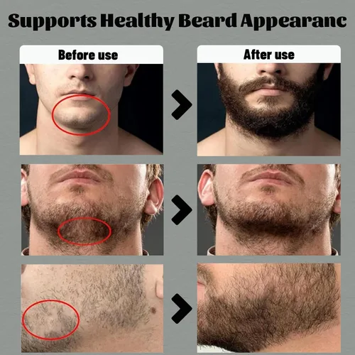 Vista 4 de Para Barba, Crecimiento De Barba Para Hombre, Bálsamo Estimulante de Barba Crema para Barba, Estimulante De Barba Ultra Potente, Bálsamo para Barba