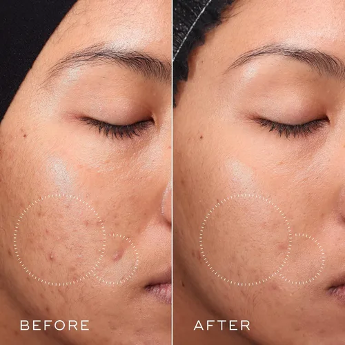 Vista 5 de Medik8 Press and Clear - Tónico facial clarificante - Tónico facial exfoliante BHA para mujeres y hombres - Tónico facial de ácido salicílico