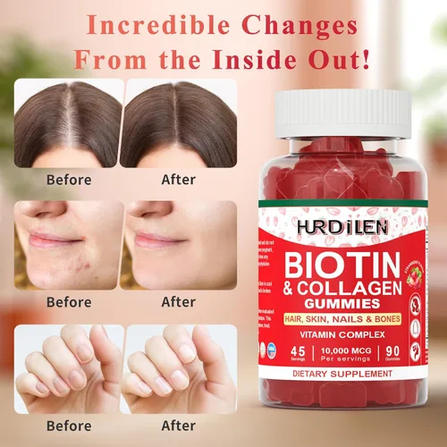 Vista 5 de Gomitas para el cabello, la piel y las uñas, 10000 mcg de biotina y colágeno para mujeres y hombres, suplementos vitamínicos que apoyan