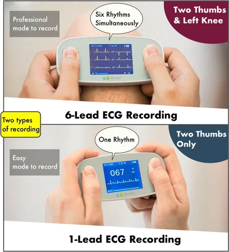 Vista 5 de EMAY 6L Monitor ECG portátil Graba ECG y frecuencia cardíaca en 6 canales Compatible con Smartphone y PC No se requiere suscripción