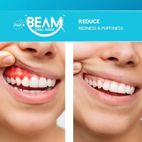 Vista 6 de PEP+ BEAM Enjuague bucal sin flúor sin alcohol con péptidos y xilitol - Enjuague oral para fortalecer el esmalte, soporte de encías y tejidos