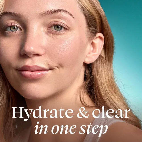 Vista 2 de TULA Skin Care Breakout Star - Hidratante para el acné, previene y trata brotes leves, ilumina las marcas, calma la piel, contiene prebióticos