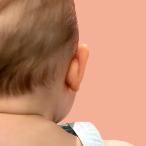 Vista 5 de Otostick Baby – 8 unidades discreto corrector de orejas sobresaliente para bebés con gorro protector para bebé, artículos ortopédicos