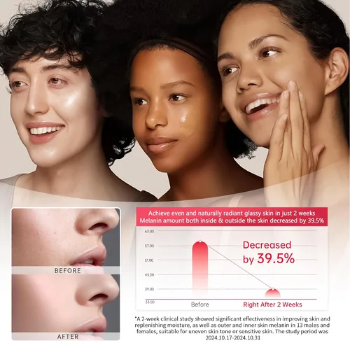 Vista 2 de Alpha Arbutin - Suero al 2% para manchas oscuras, cicatrices de acné, minimizador de poros, hidratación y eliminación de pigmentación, suero
