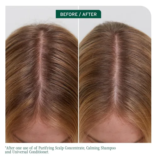 Vista 2 de Biolage Scalp Sync Calming Shampoo - Gently Cleanses Dry & Sensitive Scalps, Hydrates & Soothes, Fermented Tea Blend & Glycolic Acid, Vegan &